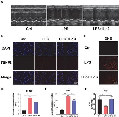 IL-13 Alleviates Cardiomyocyte Apoptosis by Improving Fatty Acid Oxidation in Mitochondria